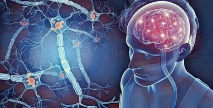 Cerebro y conexiones neuronales